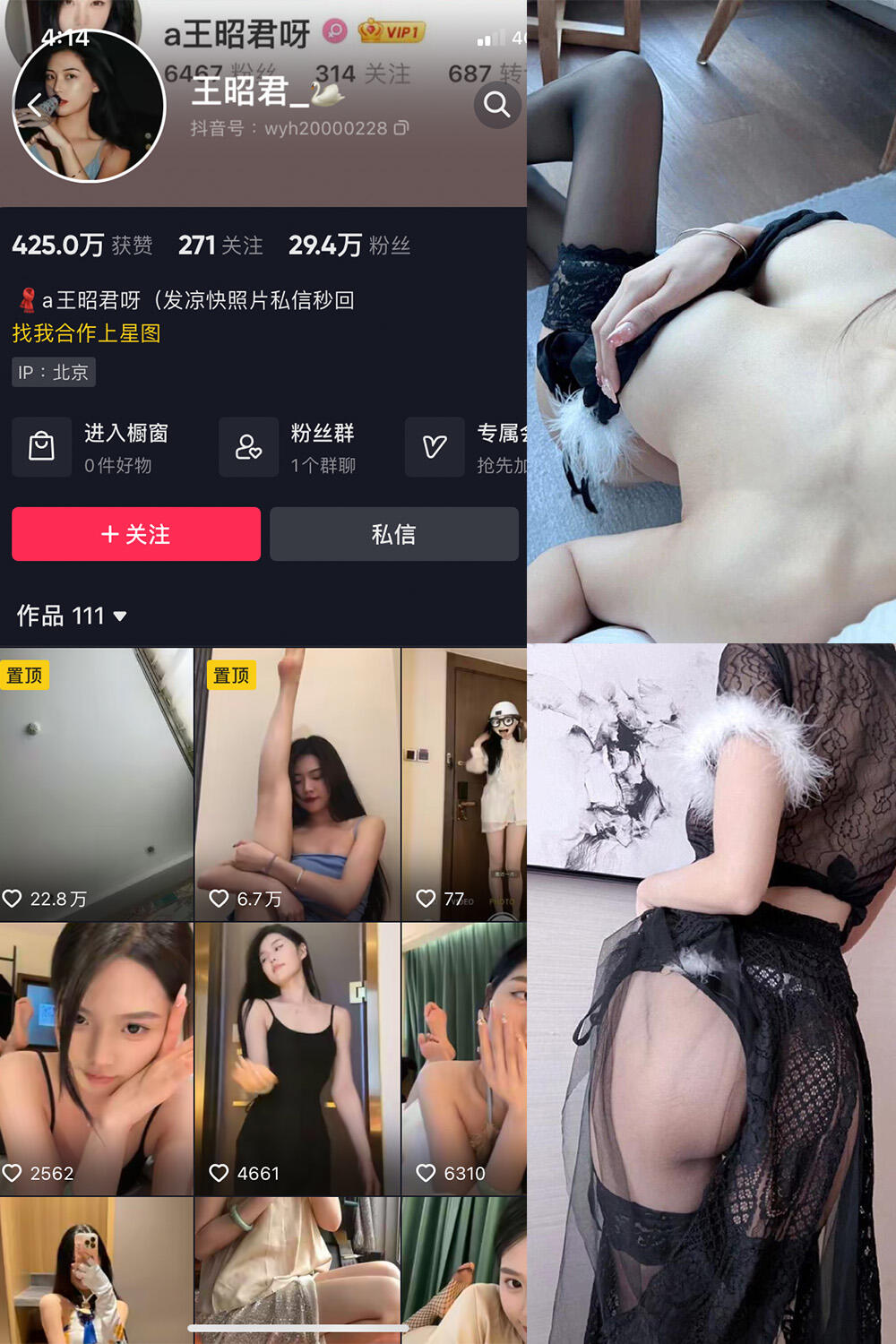 【图包+视频】王昭君 某音反差御姐微密圈写真20套合集【OneDrive/280M】