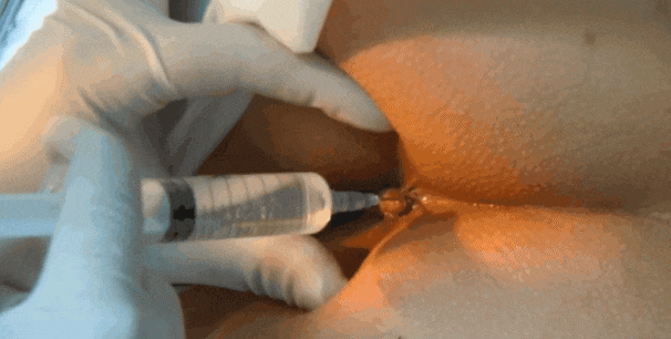DM_20250914103308_079.gif